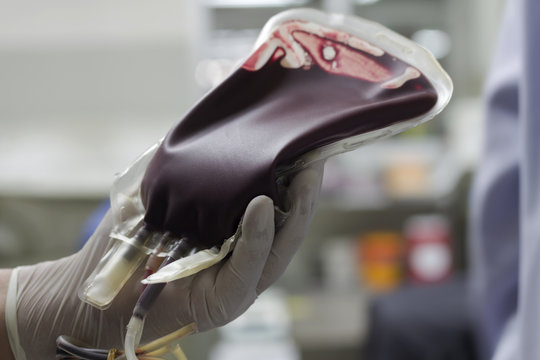 Blood in the blood bag for the patient