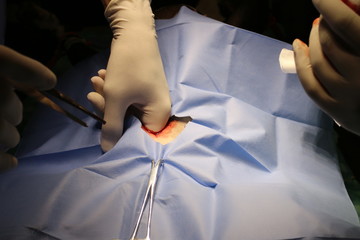 Operation - ovariectomy by dog (staffordshire terier)
