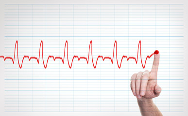 Male Doctor Hand Writing Virtual Cardiogram over Background