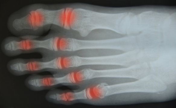 Close up foot  x-ray