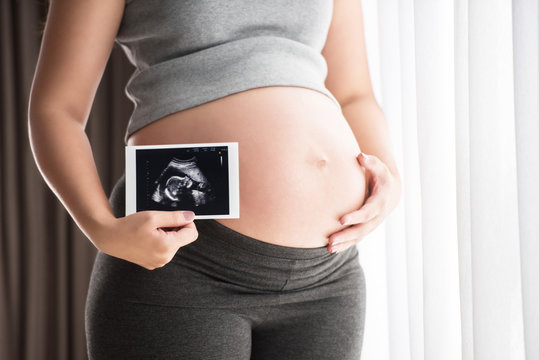 Pregnant woman touching her belly with ultrasound scan at home