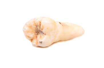 Human tooth
