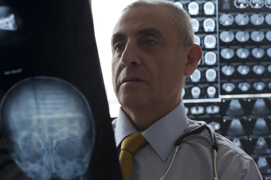 Male doctor examining x-ray of a skull