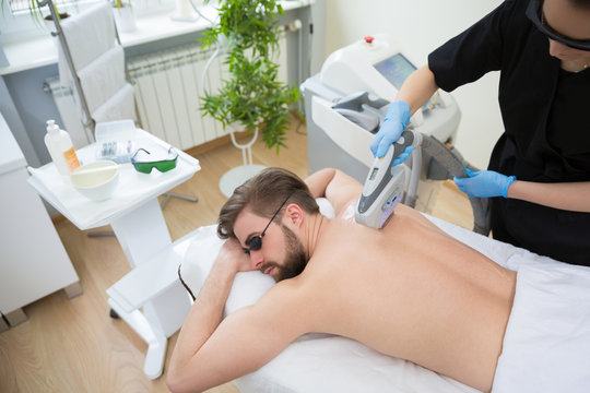 IPL therapy at men's back