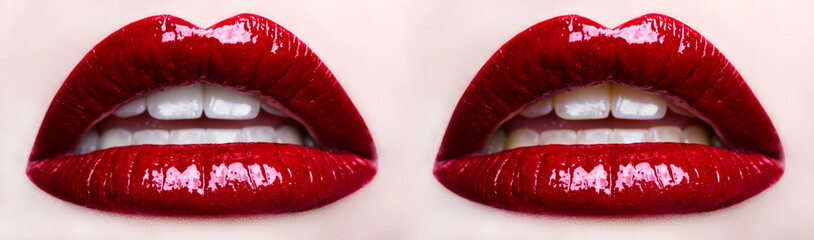 Double red lips, teeth whitening before and after