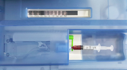 Arterial blood gas test measures the acidity and the levels of oxygen and carbon dioxide in the...