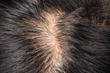 Close-up of the hair that starts to gray hair.