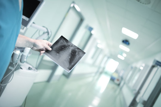 Doctor holding an x-ray image against the hospital hallway