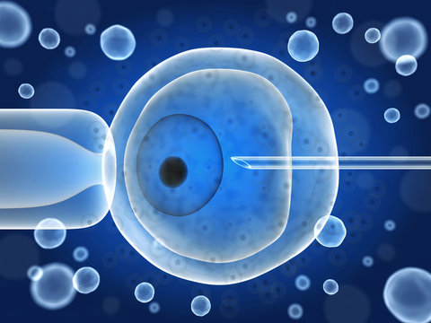 Artificial ovum fertilization