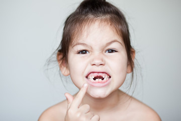 The child dropped the first milk tooth - 147077762
