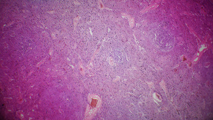 Pancreas section under the microscope - obrazy, fototapety, plakaty