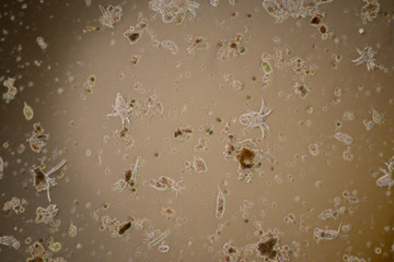 plankton under microscope view.