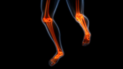 Fototapeta na wymiar Human Body Bone Joint Pains Anatomy (Leg joints)