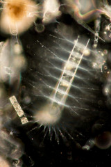 Chaetoceros (Diatom) under microscope view.