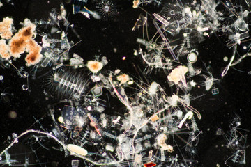 Chaetoceros (Diatom) under microscope view.