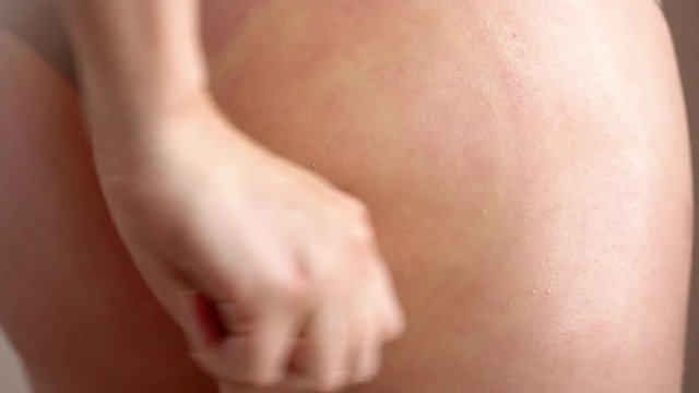 Woman having vacuum-roller massage thighs and buttocks, session slimming anti-cellulite massage