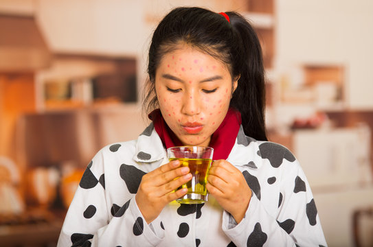 Portrait of young girl with skin problem drinking some tea