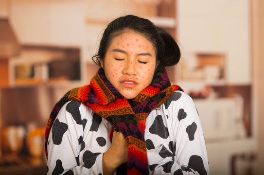Portrait of young girl with skin problem with a red wool sweater around his neck