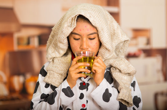 Portrait of young girl with skin problem drinking a cup of te with a grey towel in her head