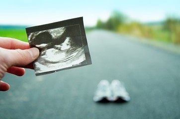 Running in pregnancy. Ultrasound image of the unborn child with running shoes and road in the background.