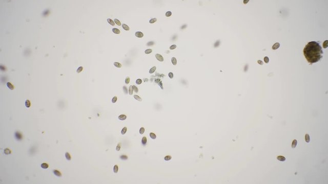 Pond life under the microscope in 4k