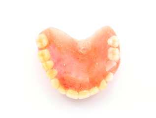 acrylic denture with metal clasps for restoring dentition.
