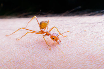 Ant biting human skin