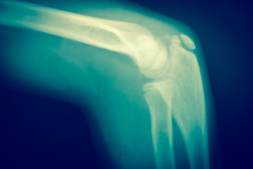Close up  bone  x-ray