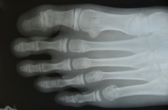 Close up foot bone