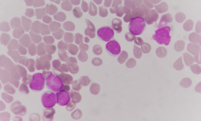 blood smear is often used as a follow-up test
