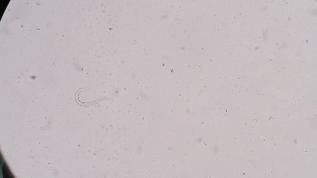 Moment of Strongyloides stercoralis (threadworm) in stool, analyze by microscope 