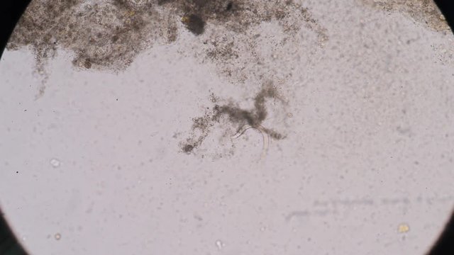 Moment of Strongyloides stercoralis (threadworm) in stool, analyze by microscope 