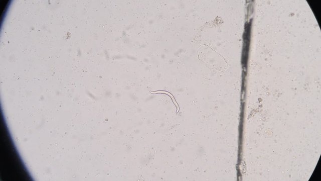 Moment of Strongyloides stercoralis (threadworm) in stool, analyze by microscope 