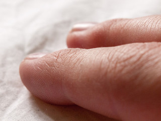 two human fingers close up with cracked detailed skin