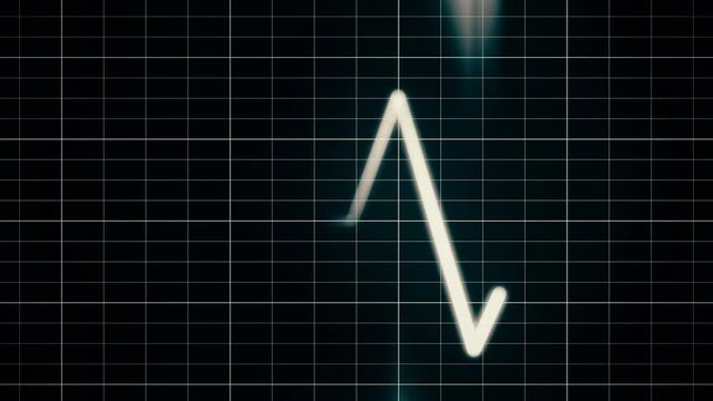 heart monitor screen