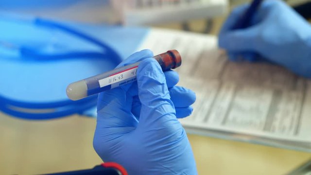 closeup of doctor holding test tube of blood