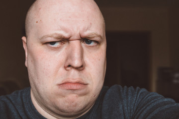 Scary expression with bulging eyes and bald head