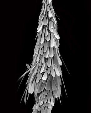 Male Culex Mosquito leg, SEM