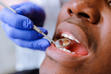 African male patient getting dental treatment in dental clinic
