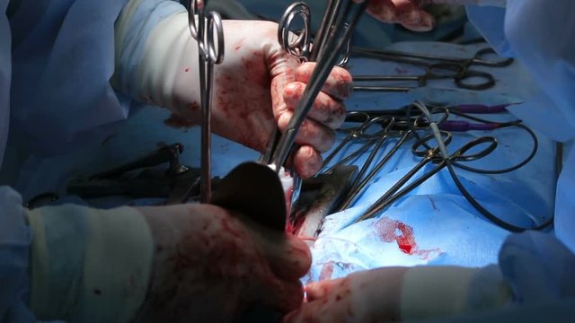 Two surgeons works close up with blood on their gloves
