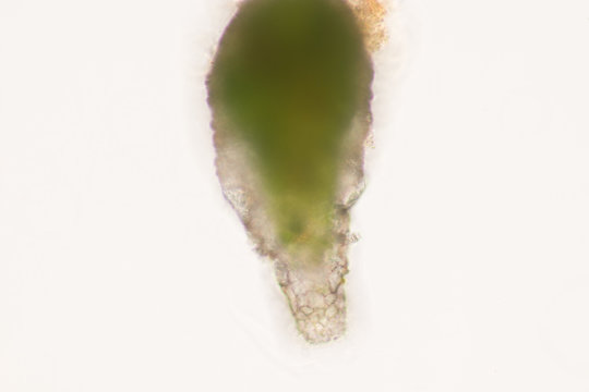 Difflugia sp.(Protozoa) under the microscope.