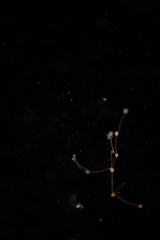 Obraz na płótnie Canvas Clathrulina elegans (Protozoa) under the microscope.