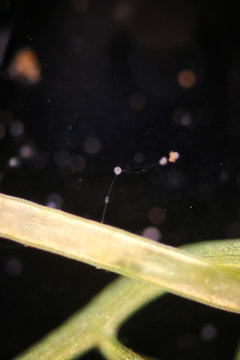 Clathrulina elegans (Protozoa) under the microscope.