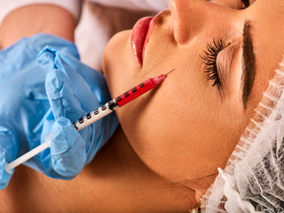 Filler injection for female forehead face. Plastic aesthetic facial surgery in beauty clinic. Botox as a cosmetic procedure. Doctor in medical gloves with syringe injects lips augmentation.
