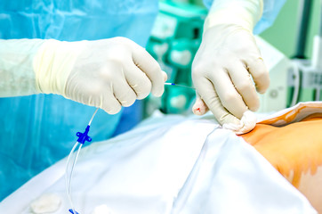An anesthesiologist installs a central venous catheter to the patient before surgery. - 150946117