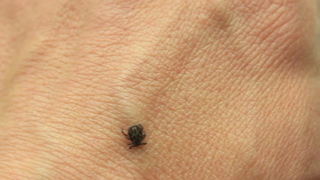 Dog Tick, Dermacentor variabilis,  Encephalitis, Ixodes scapularis on human skin
