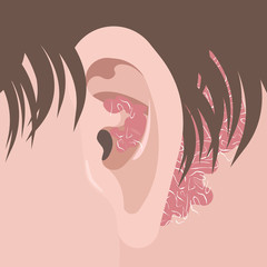 Human neck and ear with psoriasis