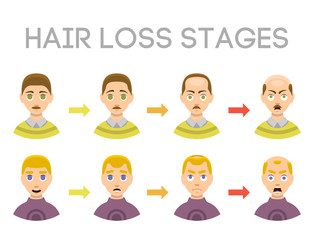 Information chart of hair loss stages types of baldness illustrated on male head vector.