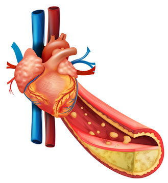 Diagram showing human heart and fat veins