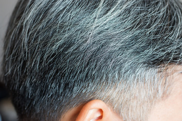 Going gray in young man shows his gray hair, hair getting grey and balding